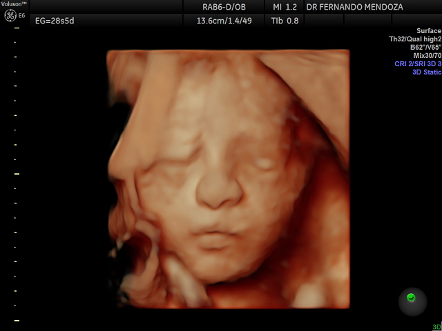 Galería de Dr. Fernando Mendoza Calderón